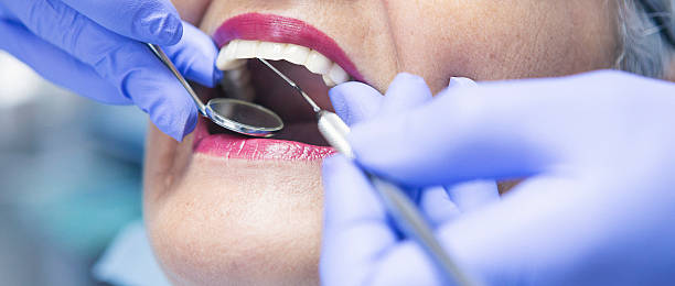 Best Emergency Dentist for Knocked-Out Tooth in Oakley, CA